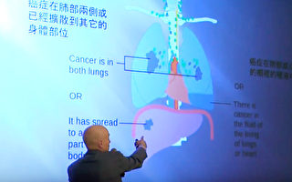 肺健康展：肺癌的预防、检查和治疗