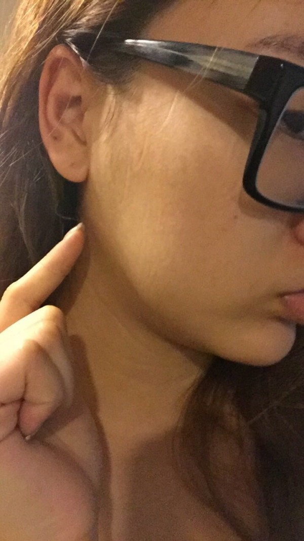 陈艾熙感冒引发腮腺炎,趁着中秋假期在家休养。(TVBS提供)