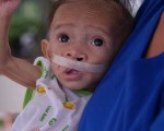 菲律宾的罗伦泰（图）9个月大，体重仅3200克。他有严重唇颚裂，却营养不良、体重不足无法开刀。罗慧夫颅颜基金会推认养计划，帮助孩子有机会开刀重获新生。
（罗慧夫颅颜基金会提供）（中央社）