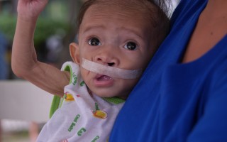 唇顎裂貧童開刀難 國際認養計畫助重生