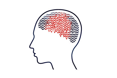 一些状况往往造成大脑产生异常，导致癫痫发作。(Shutterstock)
