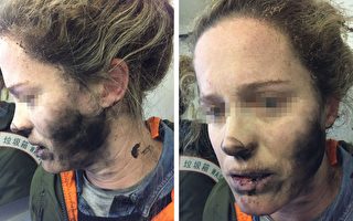 耳機電池爆炸 北京-墨市航班乘客手臉被灼傷