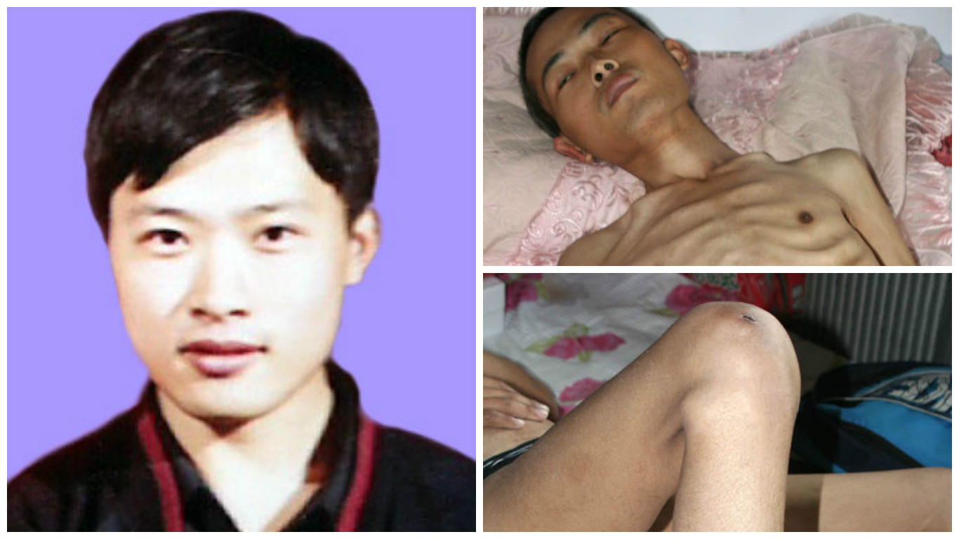 歷經中共四個監獄八年的酷刑折磨以及被打毒針,徐大為出獄時骨瘦如柴,身上留下多處電棍電擊的印痕,精神失常,出獄僅13天就含冤離世,年僅34歲。這張照片被送到川普總統顧問康威的手中,請她轉交川普總統。(明慧網)