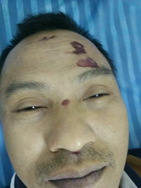 遭拘留20余天的广西凤山县凤城镇京里村村民罗继标离奇死亡，满身伤痕累累。（知情人士提供 ）