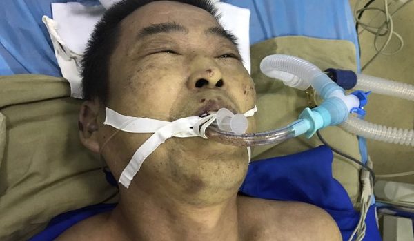 楊玉永離奇死亡，遺體傷痕累累 。（網絡圖片）