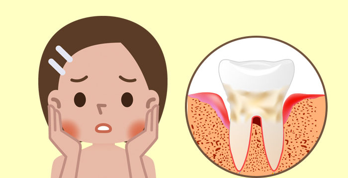 牙周病会自己好起来吗 6种症状要小心 Ismile Dental牙医 曼哈顿牙医 纽约牙医 大纪元