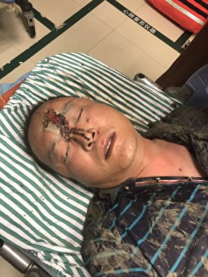 7月28日晚，浙江嘉兴市嘉善县亭桥村发生半夜强拆打人事件，一村民家中两名男子被打成重伤住院。(村民提供)