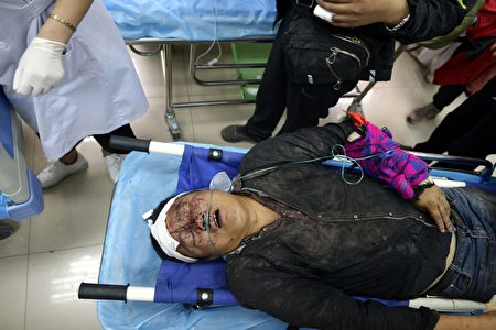 8月10日，在九寨溝縣醫院的一名傷者。（STR/AFP/Getty Images)