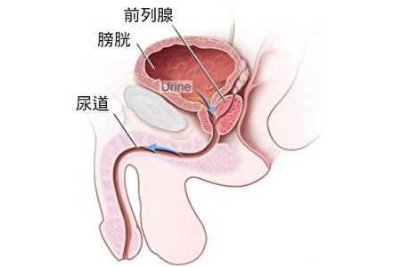 前列腺结构。(NCI／大纪元制图)