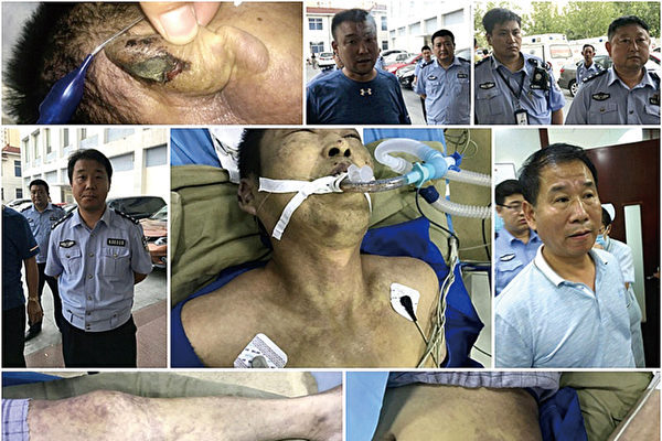 天津武清看守所将法轮功学员杨玉永被迫害致死。图为杨玉永遗体上的伤痕,及现场的警察、便衣。(大纪元合成)