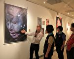 疤痕化为美丽印记 颜面伤友破茧展自信