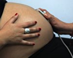 榆林產婦跳樓的背後：剖腹產有考核指標