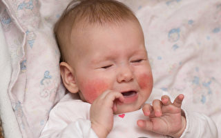 婴幼儿烧伤知多少？ 宝宝咬电源线嘴被电伤