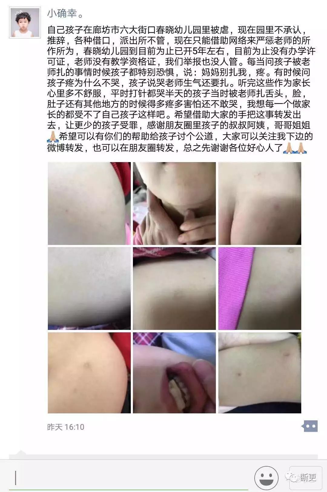 一名家长说她女儿在廊坊春晓幼儿园遭到虐待,被针扎舌头、嘴唇,但学校不承认,也拒绝提供视频,无奈之下只能求助于网络。(网络截图)