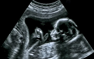 4D超声波检查 28周胎儿竟隔着肚皮对爸妈做这个手势