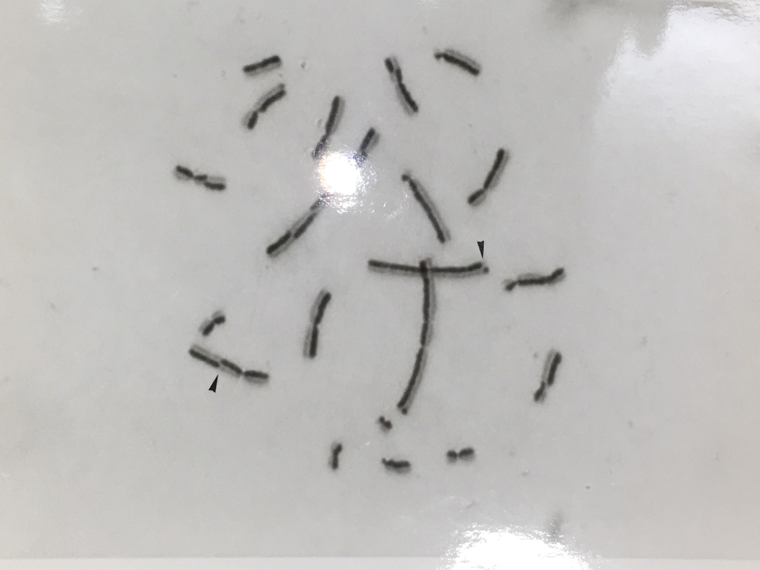 显微镜下,姊妹染色分体互换基因片段的结果。(黑色箭头指示处)<br/>(图片来源/严爱鑫提供)