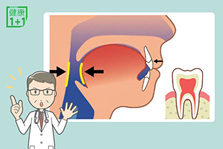 矯正可以不拔牙！這樣做解決牙齒擁擠