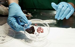 实验室培育的器官有望用于移植