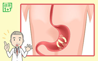 幽門螺旋桿菌是胃癌主因！5成人體內有 醫師教你防治