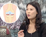 中醫2招養關節 拯救退化性關節炎