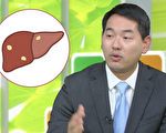 脂肪肝可變成肝癌 怎樣消除脂肪肝？