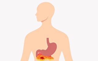 急性胰臟炎「上腹痛」是主要症狀 預防注意3點