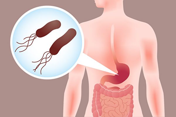 如何检查出幽门螺旋杆菌，预防胃癌