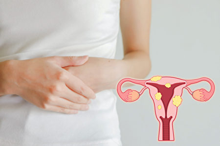 远离妇科肿瘤 中医流传至今的女性养生良方