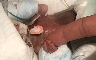 出生時僅0.27公斤 世界最袖珍男寶寶出院回家
