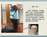 清明扫墓祭祖 医师教如何不让酸痛找上门