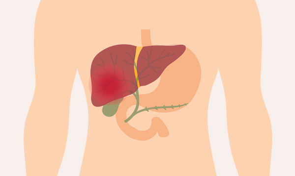 中医治疗脂肪肝，必须从肝胆、脾胃等脏腑系统同时调整。(Shutterstock)
