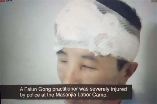 法輪功學員在馬三家勞教所被嚴重毆打致傷。（視頻截圖）