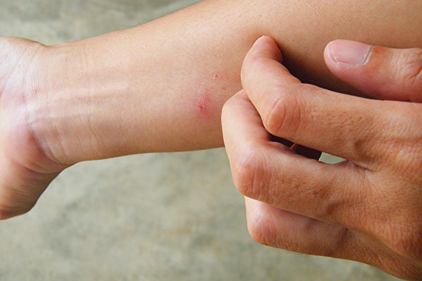 氣壯血旺體質的人，容易被蚊子叮咬，如何通過飲食和香囊防蚊？(Shutterstock)
