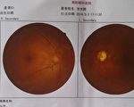 被殴打致左眼失明 陆男揭南阳市监狱黑幕