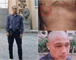 广西维权人士李燕军赴港台治病屡被拒