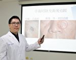 常見60歲以後 基底細胞癌年紀越大發生率越高