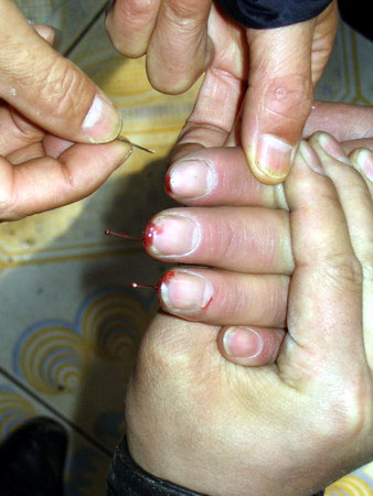酷刑演示圖：針刺手指。（明慧網）