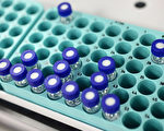 研究指唾液可显示人际交流对健康的影响