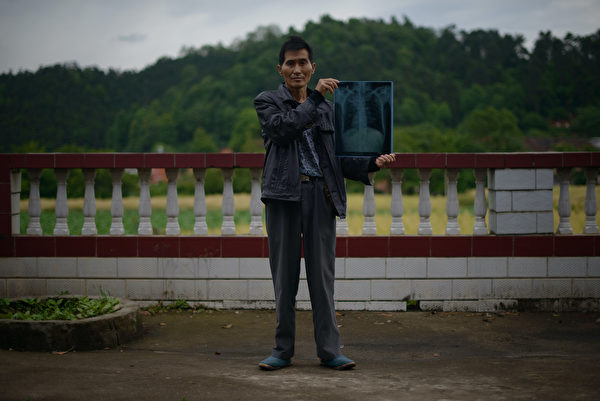 湖南工人維權抗議，圖為湖南的一名塵肺病人者，他曾是一名建築工人，攝於2013年。（Ed Jones/AFP via Getty Images）