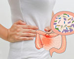 肠道可自制镇定剂 关键在平衡的肠道菌相