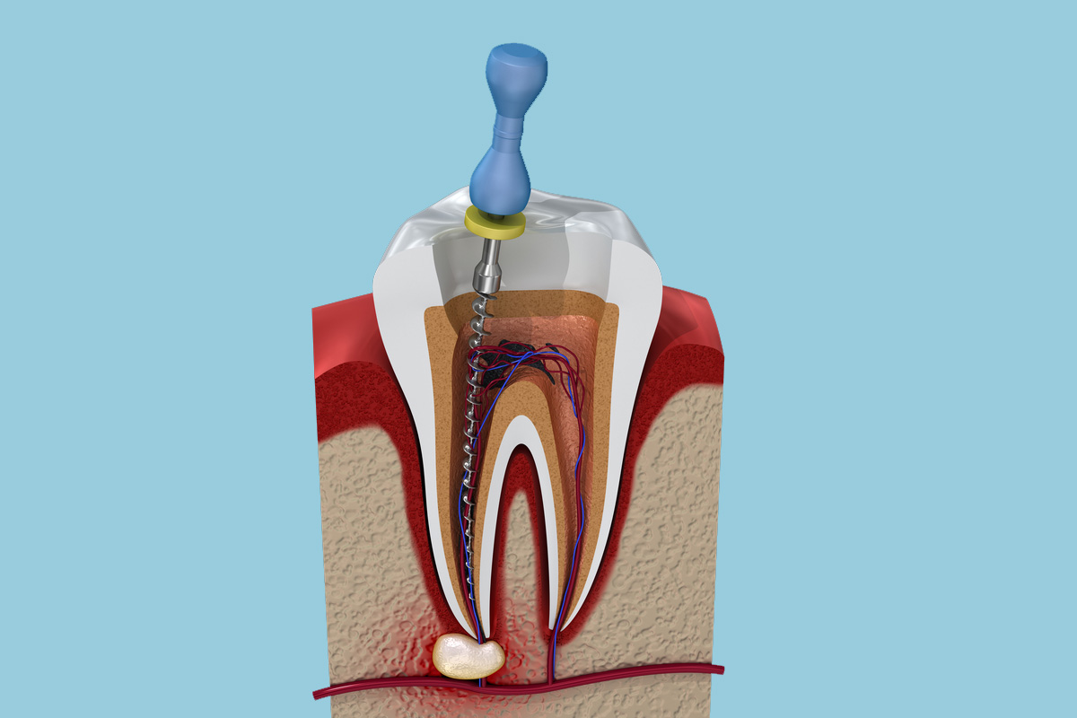 Dentist Ang 洪 牙医师