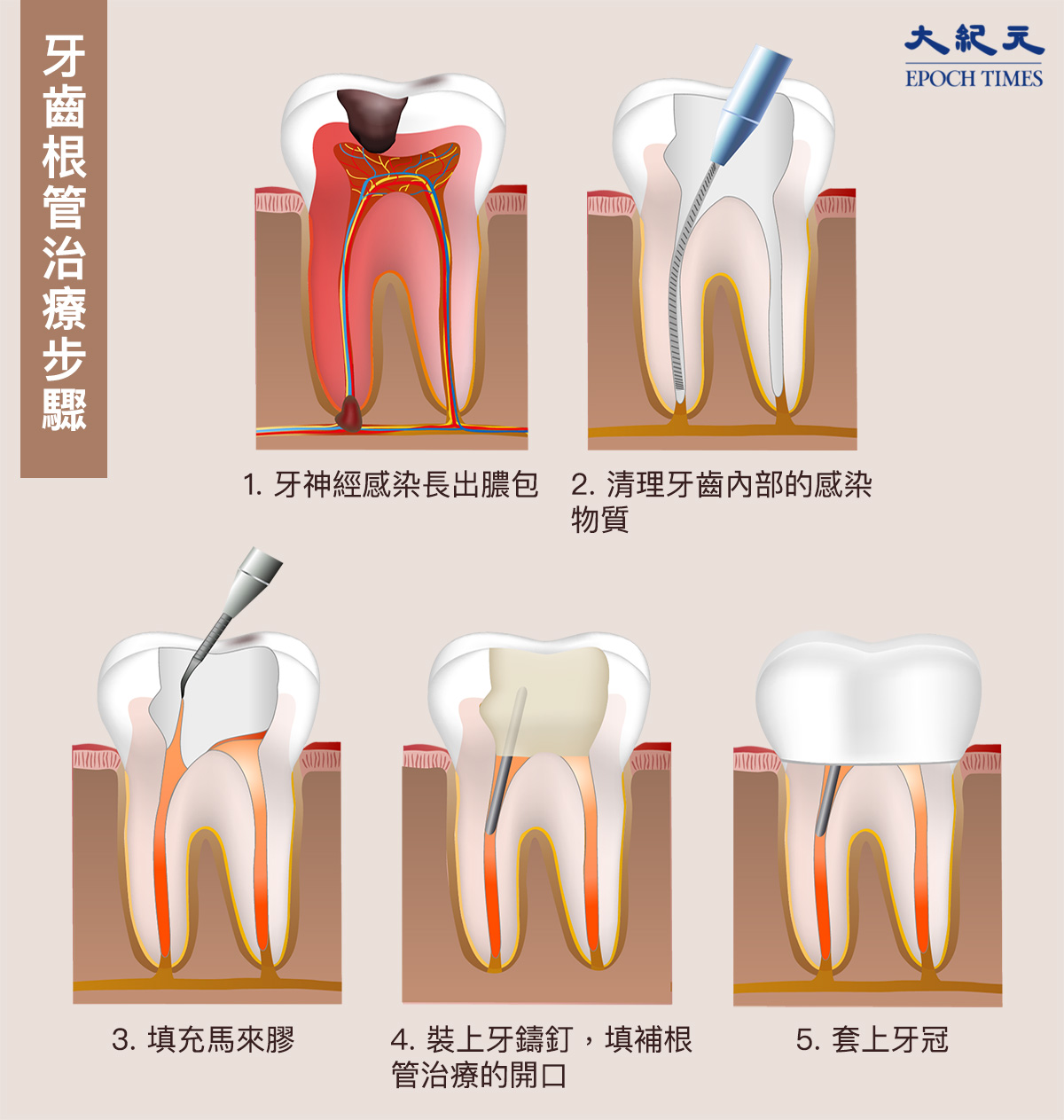 牙齒 搖晃 疼痛