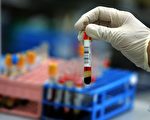 医检法规存漏洞 检测结果可有误