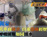 【全球疫情直击】美华裔确诊 自述恐怖经历