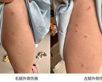 湖南省郴州市青年女企业家阳娇(化名)大腿外侧有多处抓伤痕迹。(网络图片)