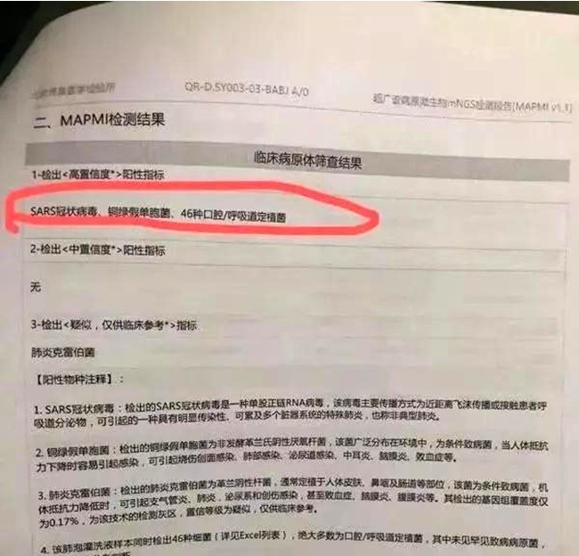 12月30日,北京博奥检测报告单传给武汉中心医院,艾芬主任在SARS上画红圈,传给各微信群组。