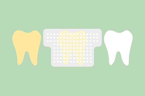 美白牙贴大多包含上下牙各1片的透明贴片，贴在牙齿上，会让牙齿变白。(Shutterstock)