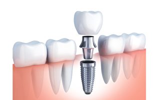 纳米技术降低植牙失败率