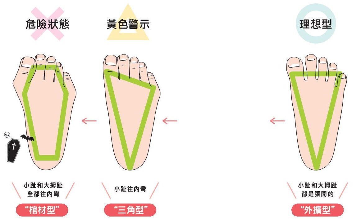 腳趾歪斜,身體也會跟著歪。自我檢視腳趾狀態。(三采文化)