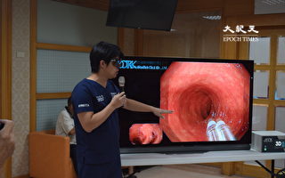 胃食道逆流擾歌喉 員生醫院3D胃腸鏡根治